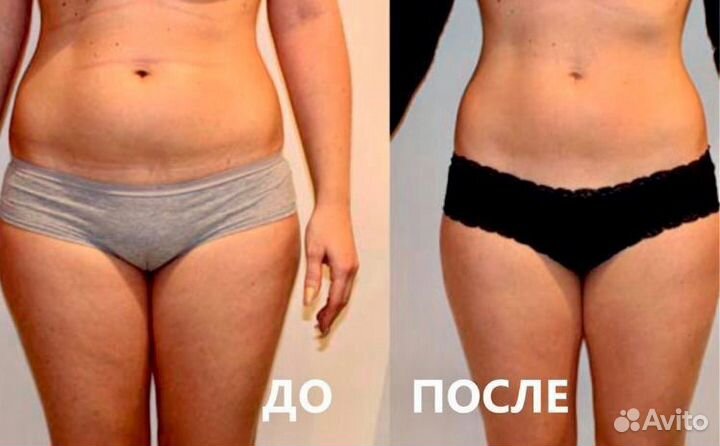 Коррекция фигуры