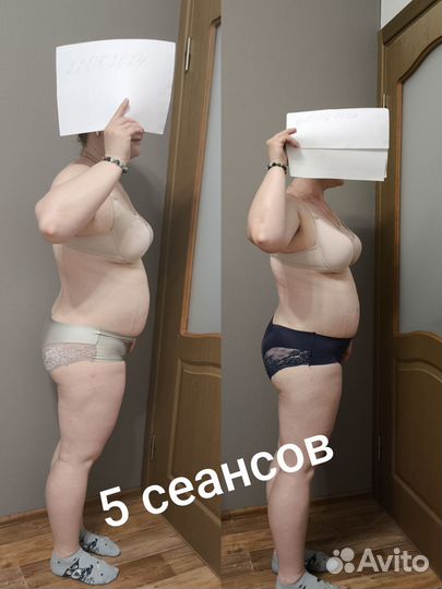 Антицеллюлитный массаж тела