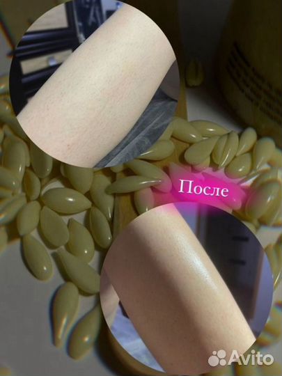 Восковая депиляция