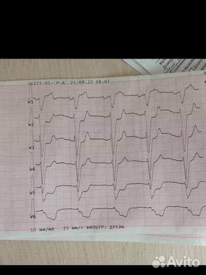Репетитор по экг