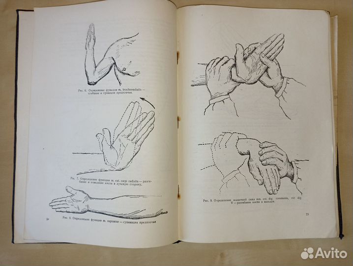 К диагностике травматических повреждений нервов ко