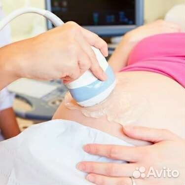 Фетальный допплер (продажа или напрокат)