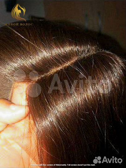 Накладка теменная