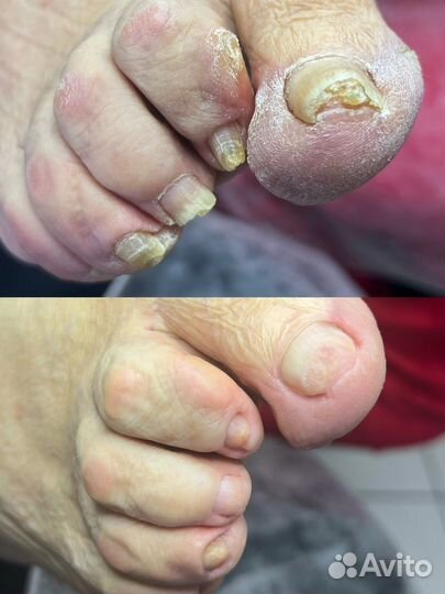 Услуги подолога