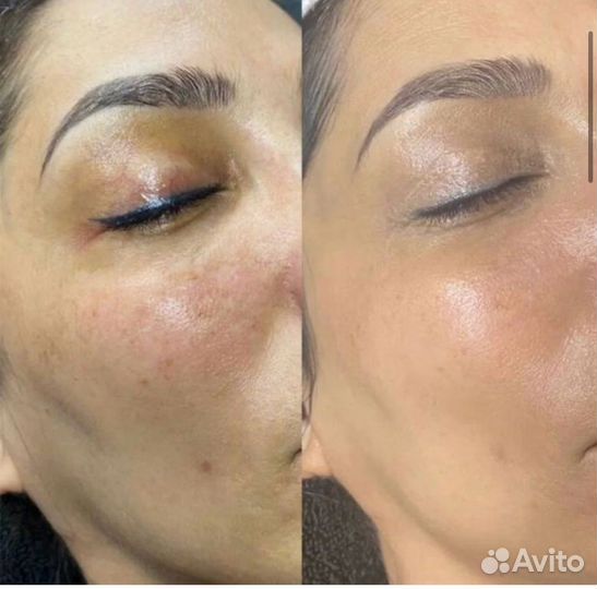 Услуги Косметолога