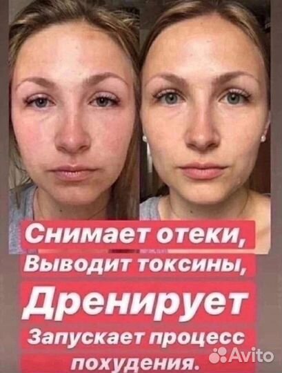 Драйнэффект