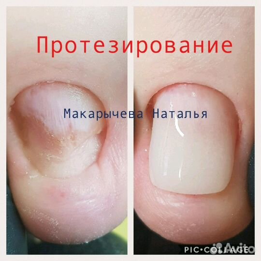 Подолог в Бутово