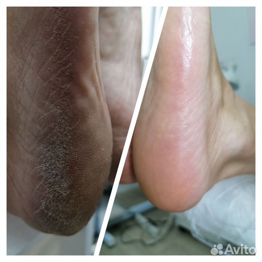 Смарт педикюр, маникюр, шугаринг