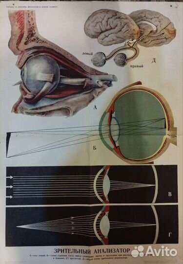 Зрительный анализатор 1977 г. Плакат