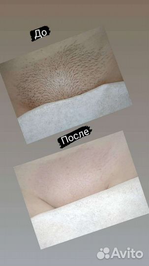 Шугаринг. Воск