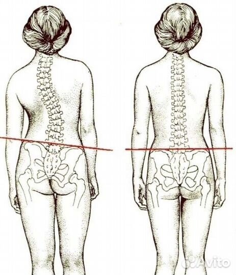 Профессиональный, оздоровительный массаж
