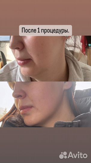 Моделирующий массаж лица