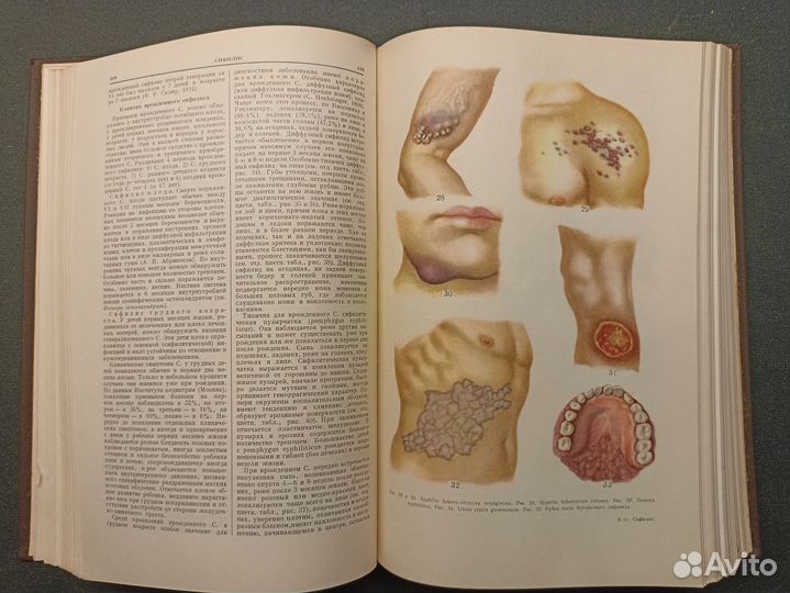 Большая медицинская энциклопедия. Том 30. 1963 