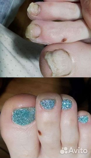 Педикюр на дому