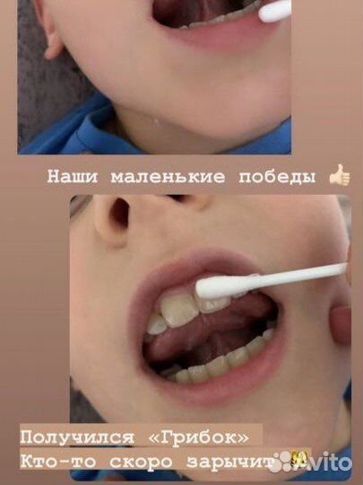 Логопед онлайн