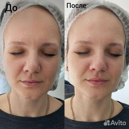 Аппаратный массаж тела и лица