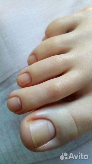 Подолог (педикюр)