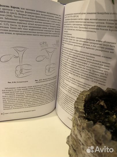 Болезни билиарного тракта у детей