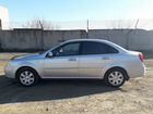 Chevrolet Lacetti 1.6 МТ, 2008, 193 000 км